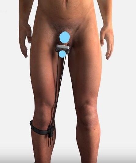 A device to increase member