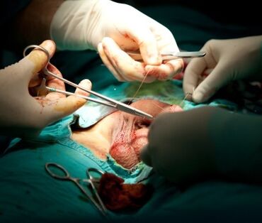 penis enlargement surgery